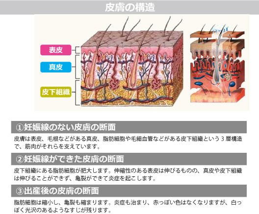 妊娠線・皮膚の構造図解