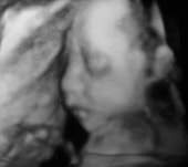 妊娠27週の胎児写真