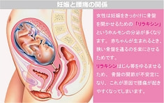 妊娠と腰痛の関係