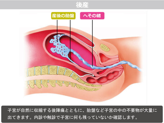 産後の処置図解