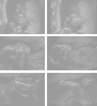 妊娠15週の胎児（超音波写真）