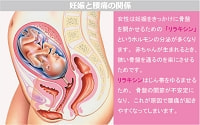 妊娠と腰痛の関係図形