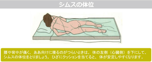 シムスの体位図解