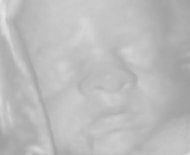 妊娠28週の胎児写真