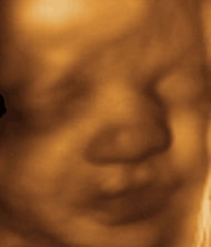 妊娠33週の胎児（表情）